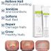 DUBUSH Anti Paronychia Relief Cream Nail Repair Solution Nail Treatment Repair Gel Nail Repair for damaged gel Toe Instant Beauty Gel for damaged discolored thick nails - Buy Online on GoSupps.com