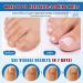 Traitement des Mycoses des Ongles 30ml - Soin Intensif l'Acide Und cyl nique 25% & Huiles Essentielles - R pare et Renforce les Ongles paissis Jaunis et Ab m s - Buy Online on GoSupps.com