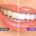 Purple Toothpaste for Teeth Whitening  Teeth Whitener  Whitening Toothpaste for Tooth Stain Removal  Fights Bad Breath 30 - Buy Online on GoSupps.com