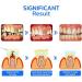 Propolis Oral Instant Treatment Spray Propolis Oral Health Spray Propolis Oral Spray Fresh Breath (5 Pcs) - Buy Online on GoSupps.com