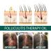 GFOUK Scalp Folliculitis Therapy Oil Folliculitis Scalp Oil Nourishing Treatment for Hair Scalp Therapy Oil Nourishing Treatment for Split Ends and Dry Scalp for All Hair Types (3PC) - Buy Online on GoSupps.com