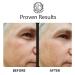 Buy Instant Ageless Eye Cream - Reduce Puffiness Tighten Skin & Smooth Fine Lines Fast | International Shipping - Buy Online on GoSupps.com