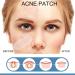 Buy Ikasus Acne Patch - 80 Hydrocolloid Pimple Dots with Tea Tree & Calendula Oil | Invisible Acne Absorbing Covers - 5 Sizes for Face & Body - International Shipping Available - Buy Online on GoSupps.com