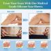 Medical Grade Silicone Scar Sheets - Reusable Scar Removal Tape for Surgical C-Section Keloid and Acne Scars - 1.6 x 60 Roll - Buy Online on GoSupps.com