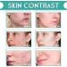 Serum Anti-Aging Facial Skin Regeneration & Repair Essence Facial Care Men and Women Moisturizing Essence Reduce Scar Fine Lines Wrinkles Acne Spots - Buy Online on GoSupps.com