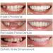 2 Pair Dentier Haut Et Bas Sourire Parfait Pour Homme Et Femme Amovible Naturel Fausse Dents Provisoire Facette Dentaire Pour Blanchiment Des Accolades - Buy Online on GoSupps.com