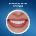 Crest 3D Whitestrips Professional Effects - 44 Strips (22 Count Pack) - Buy Online on GoSupps.com