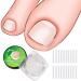 RMISODO 60 Pieces Ingrown Toenail Corrector Strips  Professional Toenail Correction Patches  Curved Toenails Straightening Recover Clips  Thick Paronychia Correction Pedicure Tool for Foot Care
