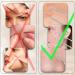 Buy SWTYEXT 6-Piece Blackhead Remover Kit - Best Pimple Extractor Tools for Clear Skin - International Shipping - Buy Online on GoSupps.com