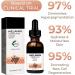 Melanin Correcting Facial Serum 30ml 2023 New Dark Spot Corrector Remover Skin Care Moisturizing Repair Serum Hyaluronic Acid Vitamin C Serum for Face (1pcs) - Buy Online on GoSupps.com