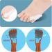 Pinky Toe Gel Bunion Protector & Separator for Pain Relief - DYKOOK Tailors Bunions, Corns, Calluses, and Blisters - Soft Gel Toe Spacers - Buy Online on GoSupps.com