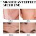Anti Aging Mens Face Cream Mens Moisturiser Face Cream With Retionl Hyaluronic Acid Moisturiser For Men Anti Wrinkle Mens Face Moisturiser Hydrated Reduce Fine Lines Non-Greasy - Buy Online on GoSupps.com