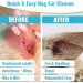Dog Ear Wipes - Finger Pads | Stop Itching - Remove Dirt Wax & Clean Dirty Ears Easily | Aloe Vera & Witch Hazel Infused | 50 Dog Ear Cleaning Finger Wipes For Easy Cleaning Of Dogs Ears | UK BRAND - Buy Online on GoSupps.com