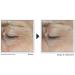 RoC Derm Correxion Dual Eye Cream with Advanced Retinol + Peptides for Puffy Eyes and Dark Circles 2 x 10mL - Buy Online on GoSupps.com