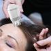 Applicateur d'huile capillaire - Zunetsutock Huile Masseur du cuir chevelu | Appareil de traitement nourrissant Distribution simple et pr cise Soin des cheveux Applicateur puissant. Il existe une - Buy Online on GoSupps.com
