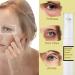 Snail Essence under Eye Cream - Ball Design Eye Bags Remover - Eye Cream for Dark Circles and Puffy Eyes - Anti Aging Eye Cream Tightening Lifting Sagging Skin - Repairing Skin - Buy Online on GoSupps.com