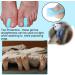 Mcvcoyh 3-Layer Foam Toe Spacer & Bunion Corrector - 8 PC Set for Bunions Pain Relief (Soft & Lightweight) - Align & Separate Toes - Buy Online on GoSupps.com