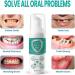 Teeth Mouthwash | Oral Mouthwash | Gum Health Mouthwash Mouthwash Toothpaste Foam Calculus Removal Teeth Whitening Eliminating Bad Breath - Solve All Oral Problems (1PC) - Buy Online on GoSupps.com