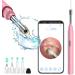QDCFY OTOSKOK Endoscopic camera tool for removing ear wax wireless otoscope with LED light for iPhone iPad and Android smartphone (black) greenen