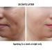 gymsegb 20% Glycolic + 10% Lactic Acid AHA Chemical Peel Professional Facial Exfoliant with 3% Hyaluronic Acid for Texture Dark Spots & Pores Fragrance Free Sensitive Skin & Melanin Safe - 30ml 1 Fl Oz (Pack of 1) - Buy Online on GoSupps.com