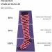 WSC Compression Socks for Men & Women - Striped Closed Toe Stockings for Edema & Pregnancy L/XL - Buy Online on GoSupps.com