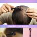 Derma Roller 540 Titanium Needles For Acne Scars Face Facial Wrinkles Hair Loss Stretch Marks Hair Operation Scars Regrowth Micro Needles Professional Micro needling Derma Needling (0.75mm) - Buy Online on GoSupps.com