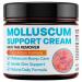 SHUNNIUB Molluscum Support Treatment Molluscum Support Cream All Natural Support Cream for Molluscum Rash