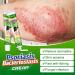 Psoriasis and Eczema Relief Cream - Soothes Dry, Itchy, and Inflamed Skin - Pack of 1 - Buy Online on GoSupps.com
