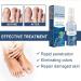 Furzero Nail Fungus & Athlete's Foot Treatment Spray - Medical Grade Anti-Itch Relief (3pcs) - Buy Online on GoSupps.com