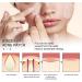 Buy Ikasus Acne Patch - 80 Hydrocolloid Pimple Dots with Tea Tree & Calendula Oil | Invisible Acne Absorbing Covers - 5 Sizes for Face & Body - International Shipping Available - Buy Online on GoSupps.com