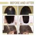 Buy Veganic Natural Rosemary Hair Oil for Growth - Nourish Dry Damaged & Thin Hair (1 Pcs) | International Shipping - Buy Online on GoSupps.com