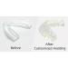 2 Pack USA-Made Mouth Guard for Grinding Teeth | Slim Anti-Grinding Night Guard - Whitening Dental Guard | Stops Bruxism, Teeth Clenching | BPA-Free - Buy Online on GoSupps.com