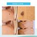 Skin Tag Remover Patches - Natural Ingredients - 120 Patches - 3 Pack - Buy Online on GoSupps.com