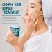 Crepey Skin Repair Treatment-Skin Tightening Cream for Body & Face | Firming Cream for Loose/Sagging Areas | Reduces Fine Lines Smooths Crepey Texture | All Types Deep Hydration Fast-Absorbing (2PCS) - Buy Online on GoSupps.com