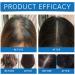 S rum Cheveux Croissance Hair Growth Serum Roll-on Advanced Hair Growth Serum Acc l re La Pousse Des Cheveuxs R duit La Chute Des Cheveuxs Pour Tous Types De Cheveux 25ml - Buy Online on GoSupps.com