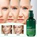 Skin Firming Rejuvenating Serum with Hyaluronic Acid - Anti-Aging Facial Serum for All Skin Types | 2.7 oz - Buy Online on GoSupps.com