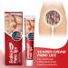 Cr me Anti-D mangeaisons Apaisante et Rafra chissante Gel Hydratant pour Secheresse Vaginale Cr me Hydratante Intime Anti-D mangeaisons Pommade de Soin 20G - Buy Online on GoSupps.com