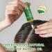 Batana Oil for Hair Growth Botana Oil Botana Hair Growth Oil Raw Batana Oil Organic Batana Oil Botana Oil Organic Promote Hair Growth Repair Damaged Hair Suitable for Men and Women (100ml) - Buy Online on GoSupps.com
