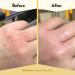 Organic ECZEMA HONEY Nut-Free Skin-Soothing Cream - Natural Hand & Body Relief for Dry, Itchy Skin - 4 Oz - Buy Online on GoSupps.com
