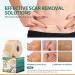 Geloo Professional Silicone Scar Sheets 4.06M - Extended Edition for C-Section Keloid Surgery Burn Scar - Reusable Silicone Gel Strips (1.6 * 160) - Shop Now - Buy Online on GoSupps.com