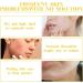 Azelaic Acid Cream Face Skin Care Beauty with Niacinamide & Vitamin C Azelaic Acid Suspension 10% Face Serum Reduce Blemishes Remove Acne&Rosacea Shrink Pore Face Cream for All Skin Types 30ML (1) - Buy Online on GoSupps.com