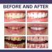 Teeth Brightening Purple Toothpaste 30ml | Instant Whitening & Stain Removal | All Ages | Perfect for Weddings & Events - Buy Online on GoSupps.com