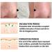 Effective Blackhead Remover Nose Strips - Pore Strips for Clear Skin | 30g (1 Pack) - Buy Online on GoSupps.com