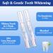 Lagunamoon Teeth Whitening Kit | 35% Urea Peroxide Gel with LED Light | No Sensitivity | Remove Coffee, Wine, Tea Stains - Buy Online on GoSupps.com