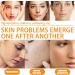 Vitamin E Face Serum Vitamin E Oil With Hyaluronic Acid Antioxidant Facial Serum for Ageing Skin Vitamin E Serum for Face Skin Moisturizes Collagen Serum For For Fine Line Quickly Absorb - Buy Online on GoSupps.com