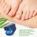 Home-Use Nail Fungus Laser Device with LED Blue Light Therapy - Buy Online on GoSupps.com