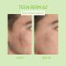 ISISPHARMA TEEN DERM A.Z Soin Triple Action Anti-Imperfections Anti-Marques Ultra Apaisant Peaux Mixtes Grasses - Avec 15% d Acide Az la que - Fabrication Fran aise - Buy Online on GoSupps.com