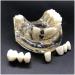 Implant Tooth Template | Oral Simulation Dental Study Model for Teaching - Shop Internationally - Buy Online on GoSupps.com