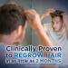 Amazon Basic Care Minoxidil 5% Foam Hair Regrowth Treatment for Men - 6.33 oz - Buy Online on GoSupps.com