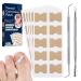 Ingrown Toenail Treatment  No Glue Ingrown Toenail Corrector - Painless Pedicure Toenail Corrector Patch Strips  With Nail Correction Tools 50 Patches with Nail Correction Tools Blue